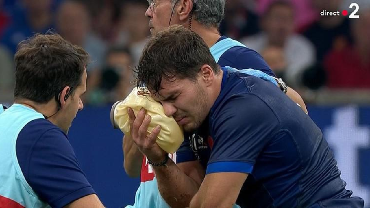 Coupe du monde de rugby 2023 Antoine Dupont blessé au visage Johan