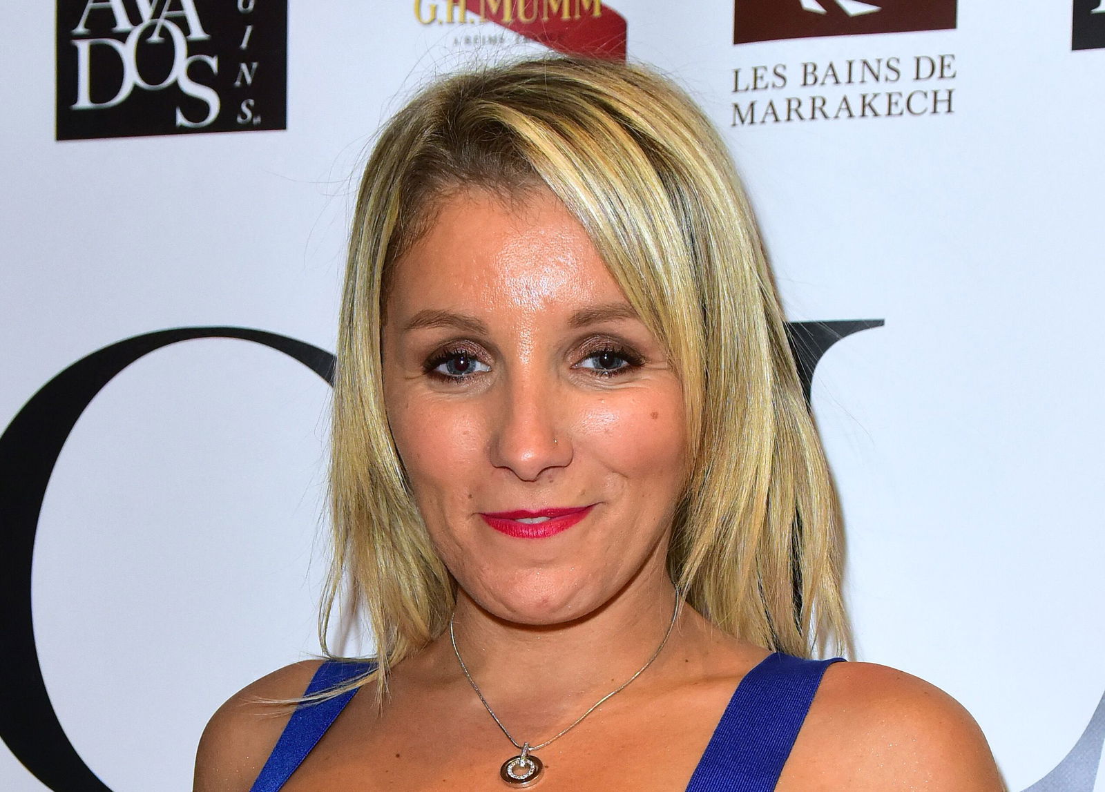 Myriam Abel Perte de poids, injections... la chanteuse fait sensation